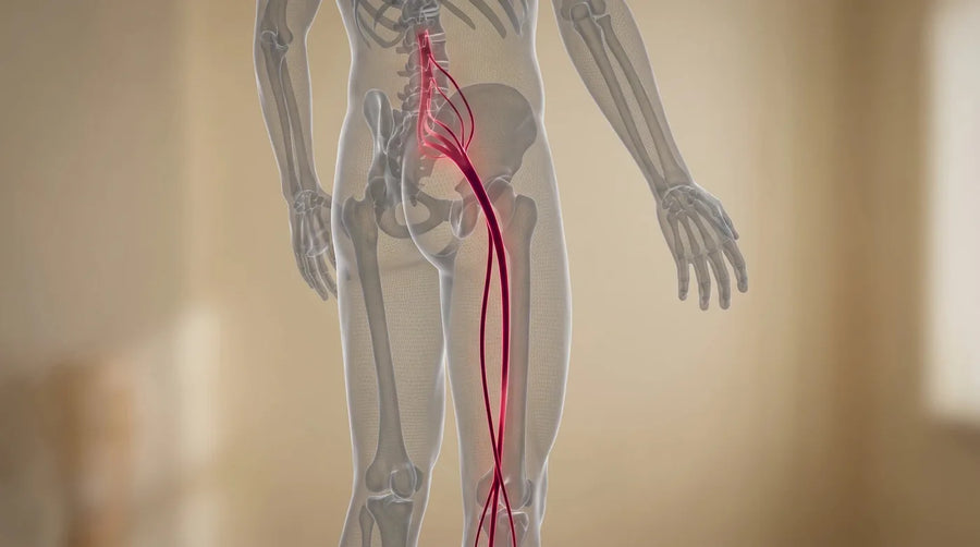 Sciatica and radiating pain