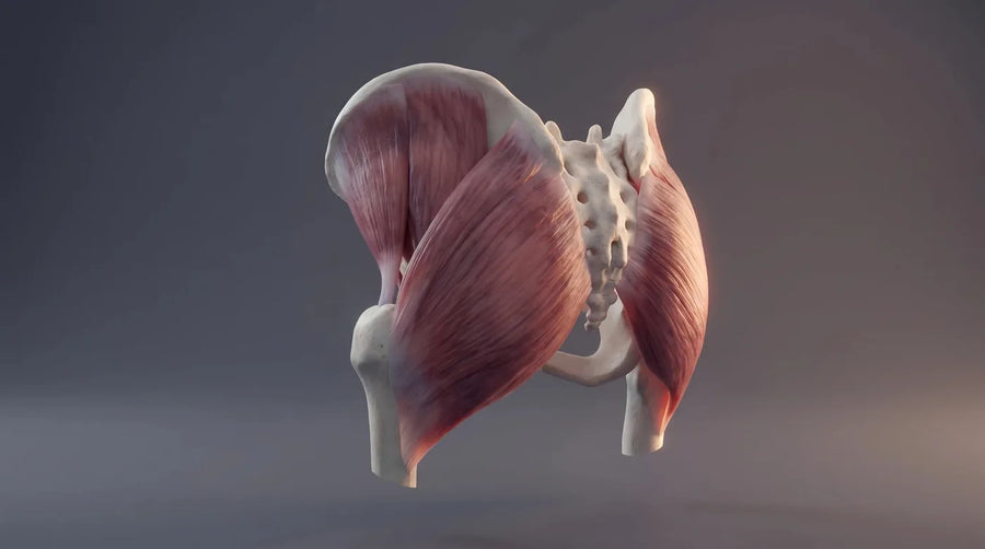Piriformis syndrome